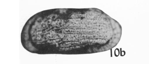 Cytheromatidae image